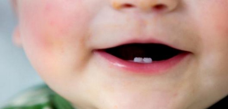 At the child the teeth are cut