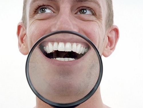 How to deal with white spots on the teeth