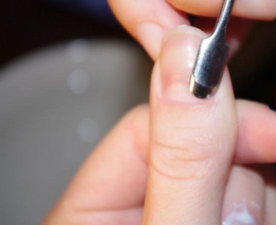 Cuticle Removal