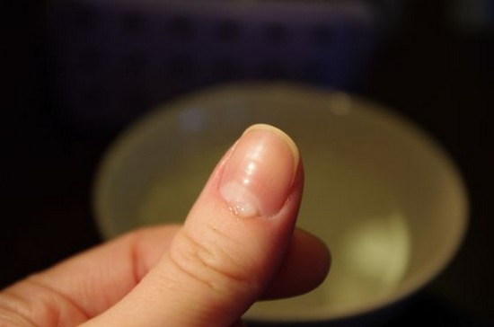 Cuticle Removal