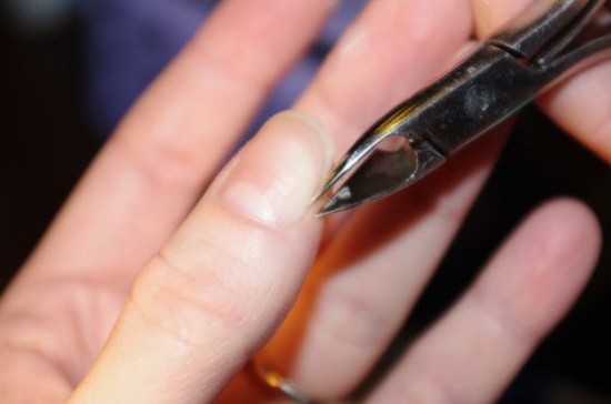 Cuticle Removal