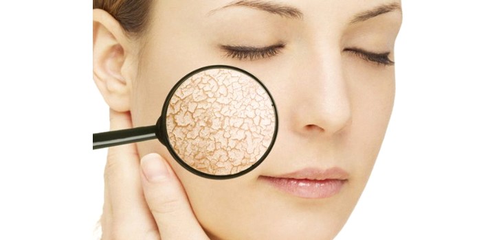 Oils, masks and creams for dry skin