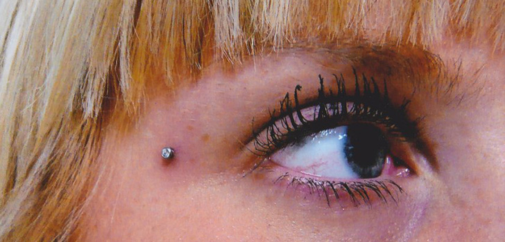 Microdermal piercing: how microdermabras are made (photo)