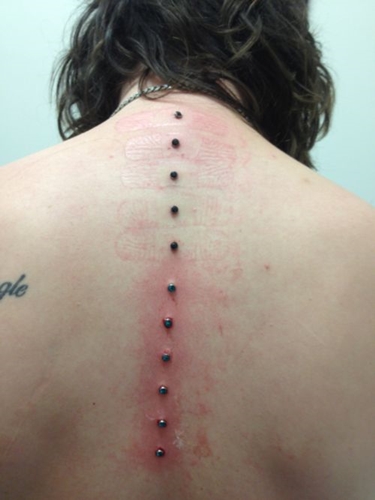 Microdermal piercing: how microdermabras are made (photo)