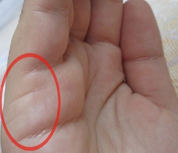 The marriage line on the hand