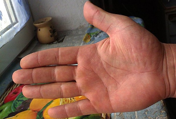 The marriage line on the hand