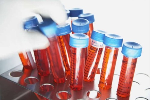 Analyzes for antimulylerov a hormone