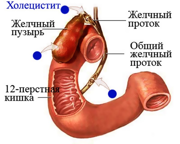 Pain in right side at waist level