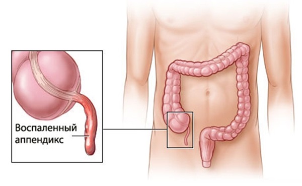 Pain in right side at waist level