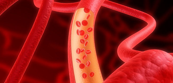 Cleaning of cerebral vessels