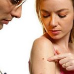 What will happen if you tear off a mole What will happen if you tear off a mole