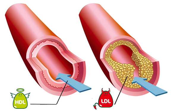 Cholesterol: myths, truth and recommendations of nutritionists