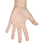 How to get rid of warts on your hands How to get rid of warts on your hands