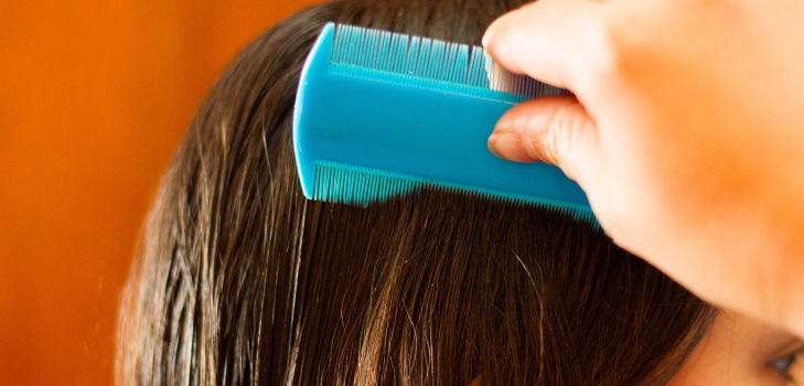 How to get rid of nits