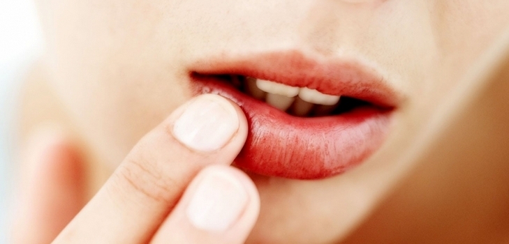 recipes for treating colds on the lips