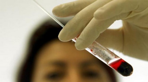 HCG during pregnancy