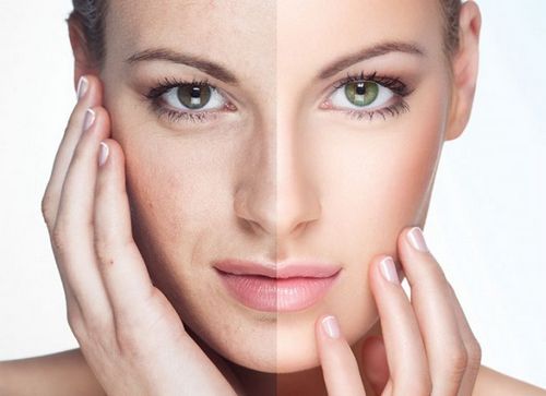 How to Get Rid of Small Vessels on Your Face