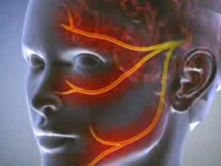 Neuralgia: symptoms, photos, treatment