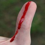 First aid for bleeding First aid for bleeding