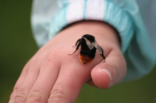 First aid with a bee sting