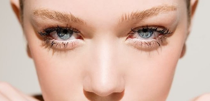 Eyelid lift, photo