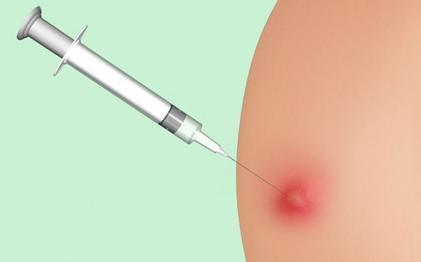 The cone after the injection in the buttock does not resolve: treatment of the compaction and bruise after the injection in the buttock