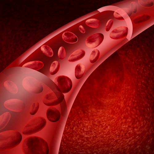 Vasculitis - what is it? Symptoms, photos, treatment